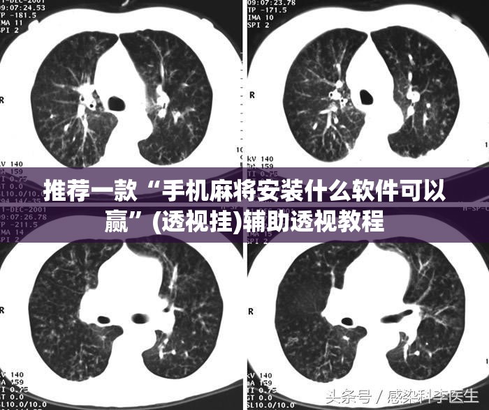 推荐一款“手机麻将安装什么软件可以赢”(透视挂)辅助透视教程