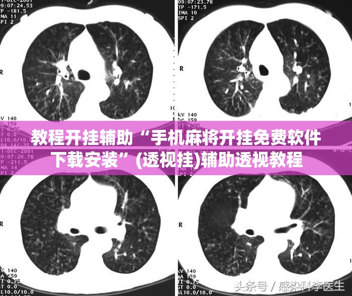 教程开挂辅助“手机麻将开挂免费软件下载安装	”(透视挂)辅助透视教程