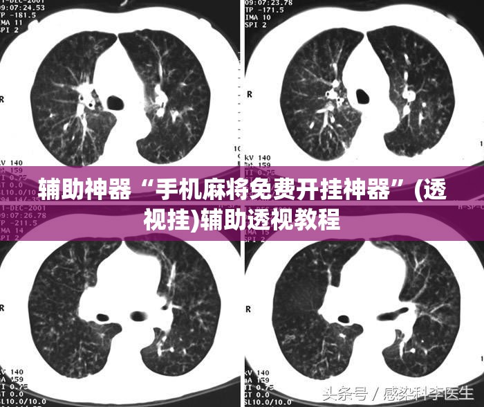 辅助神器“手机麻将免费开挂神器”(透视挂)辅助透视教程