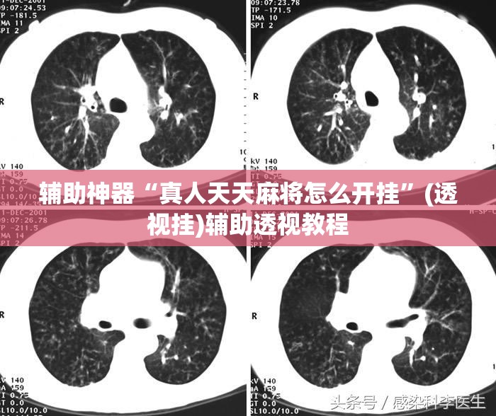 辅助神器“真人天天麻将怎么开挂”(透视挂)辅助透视教程