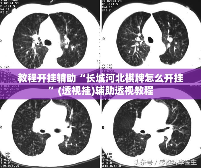 教程开挂辅助“长城河北棋牌怎么开挂”(透视挂)辅助透视教程