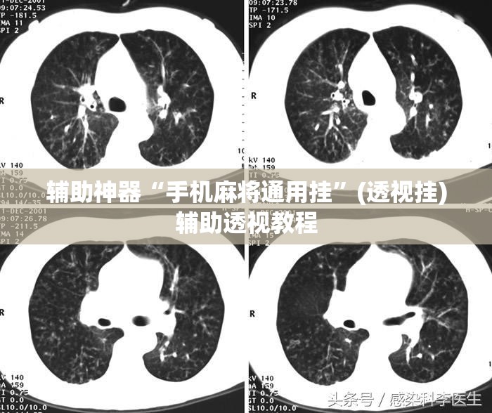 辅助神器“手机麻将通用挂”(透视挂)辅助透视教程