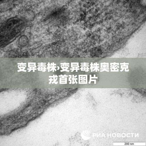 变异毒株›变异毒株奥密克戎首张图片 变异毒株›变异毒株奥密克戎首张图片