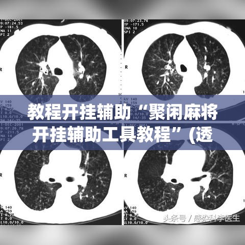 教程开挂辅助“聚闲麻将开挂辅助工具教程”(透视挂)辅助透视教程