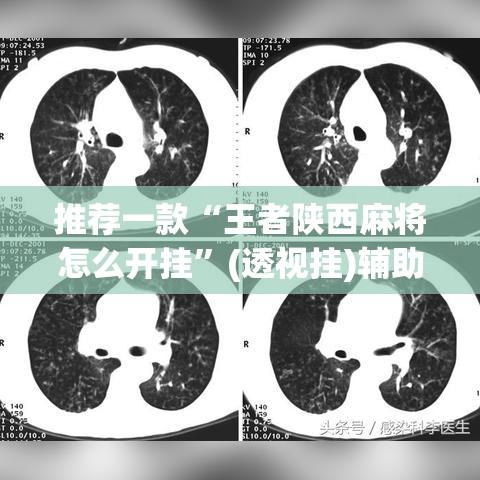 推荐一款“王者陕西麻将怎么开挂”(透视挂)辅助透视教程