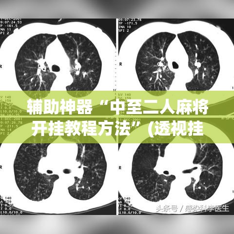 辅助神器“中至二人麻将开挂教程方法	”(透视挂)辅助透视教程