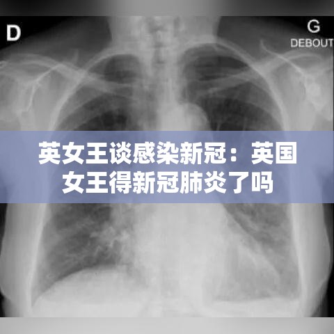 英女王谈感染新冠：英国女王得新冠肺炎了吗