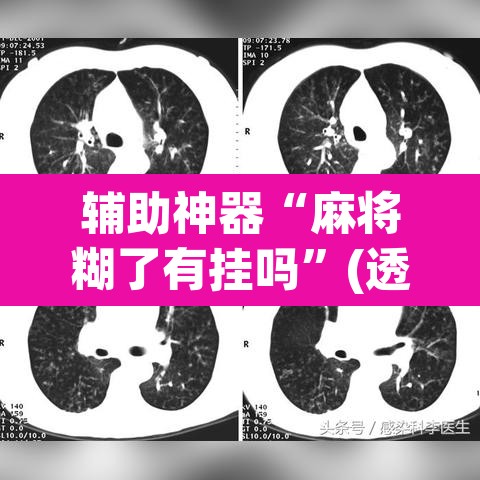 辅助神器“麻将糊了有挂吗”(透视挂)辅助透视教程
