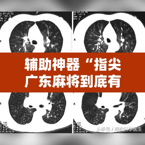 辅助神器“指尖广东麻将到底有没有挂”(透视挂)辅助透视教程