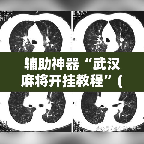 辅助神器“武汉麻将开挂教程”(透视挂)辅助透视教程