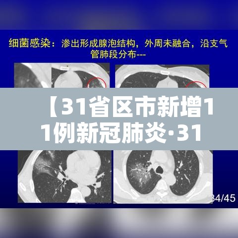 【31省区市新增11例新冠肺炎·31省区市新增病例8例】 【31省区市新增11例新冠肺炎·31省区市新增病例8例】