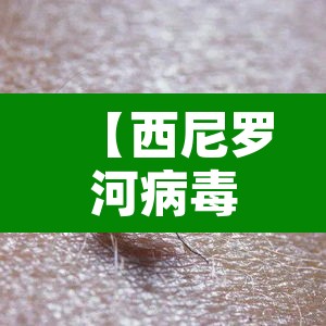 【西尼罗河病毒,西尼罗河病毒是什么】 【西尼罗河病毒,西尼罗河病毒是什么】